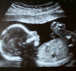 Letter to my unborn&nbsp;child